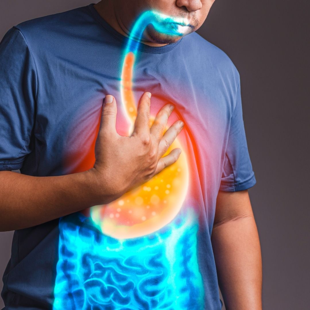 Man clutching his chest with colored overlay showing stomach and acid reflux rising into his esophagus