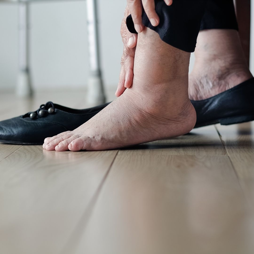 Tips on Taking Care of Your Feet When You Have Diabetes