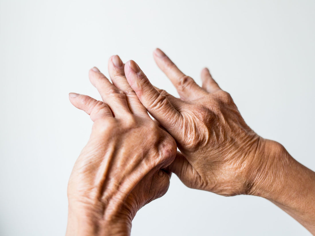 Hands holding one another with visibly enlarged, crooked finger joints against a white background