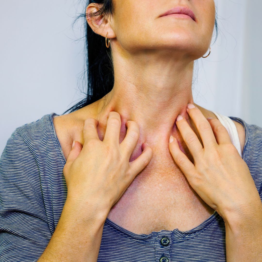 Person scratching red, irritated skin on their neck and upper chest