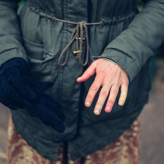 Person wearing a green coat with discolored fingers from poor circulation, showing the need to keep skin healthy all year long.