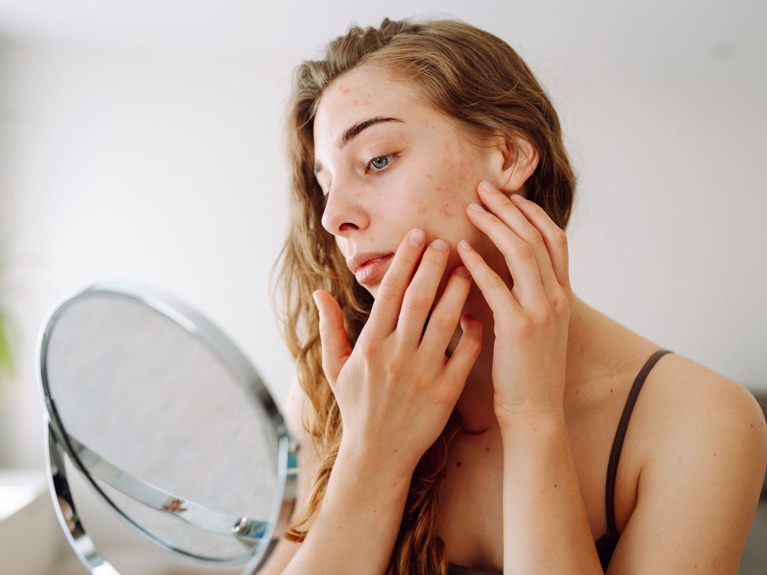 Woman looking at her skin in a mirror