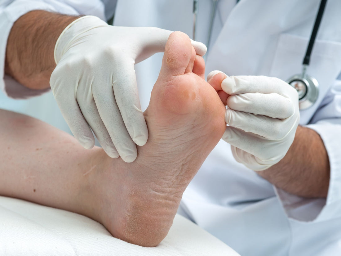Jock Itch and Athlete's Foot