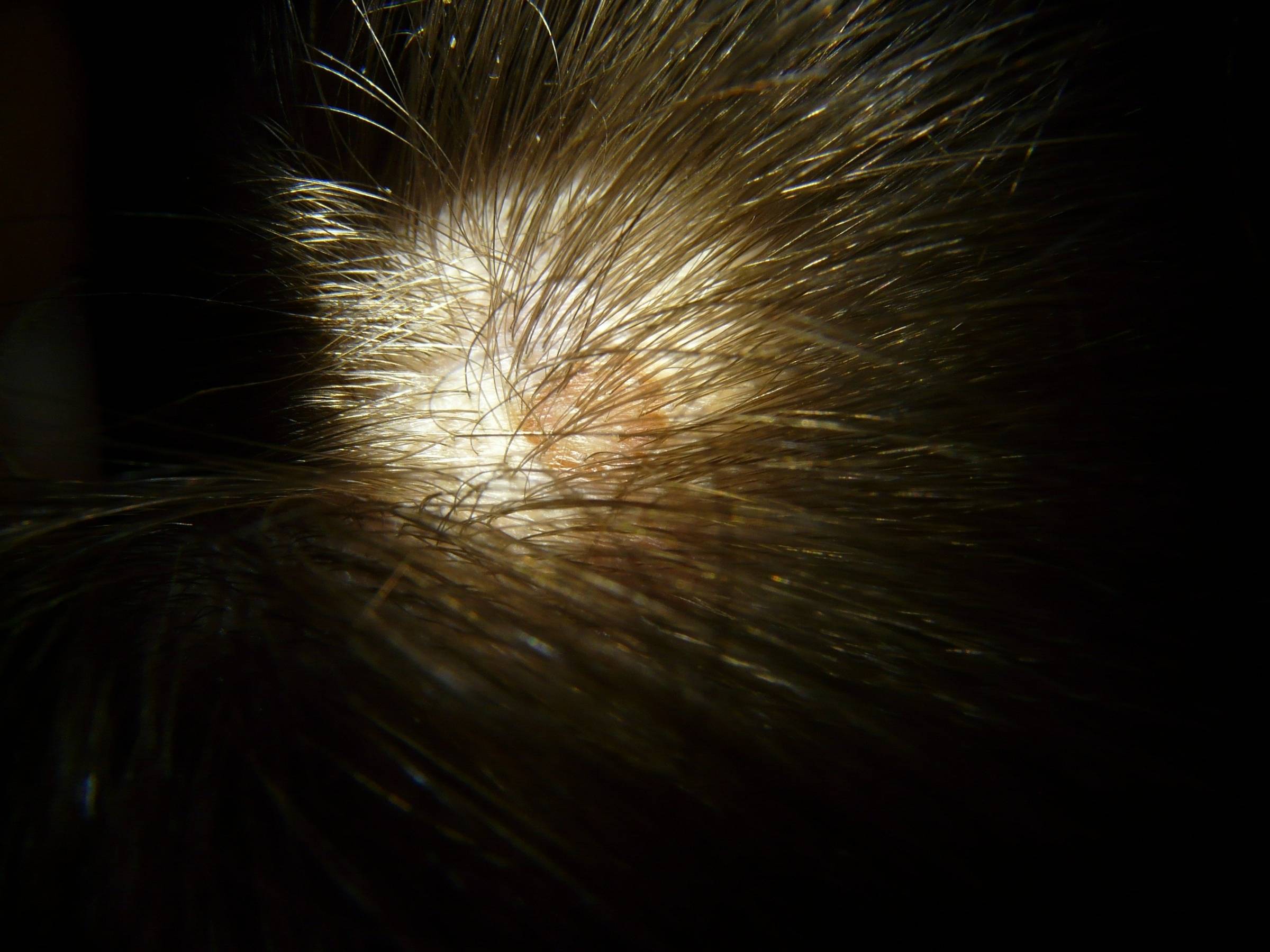 Beating the Itch: Your Guide for Dealing with Scalp Ringworm