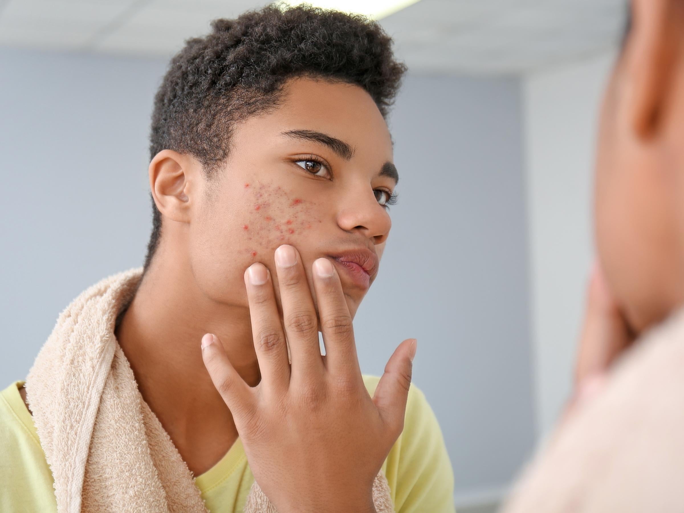 Teen boy looking at his acne in the mirror
