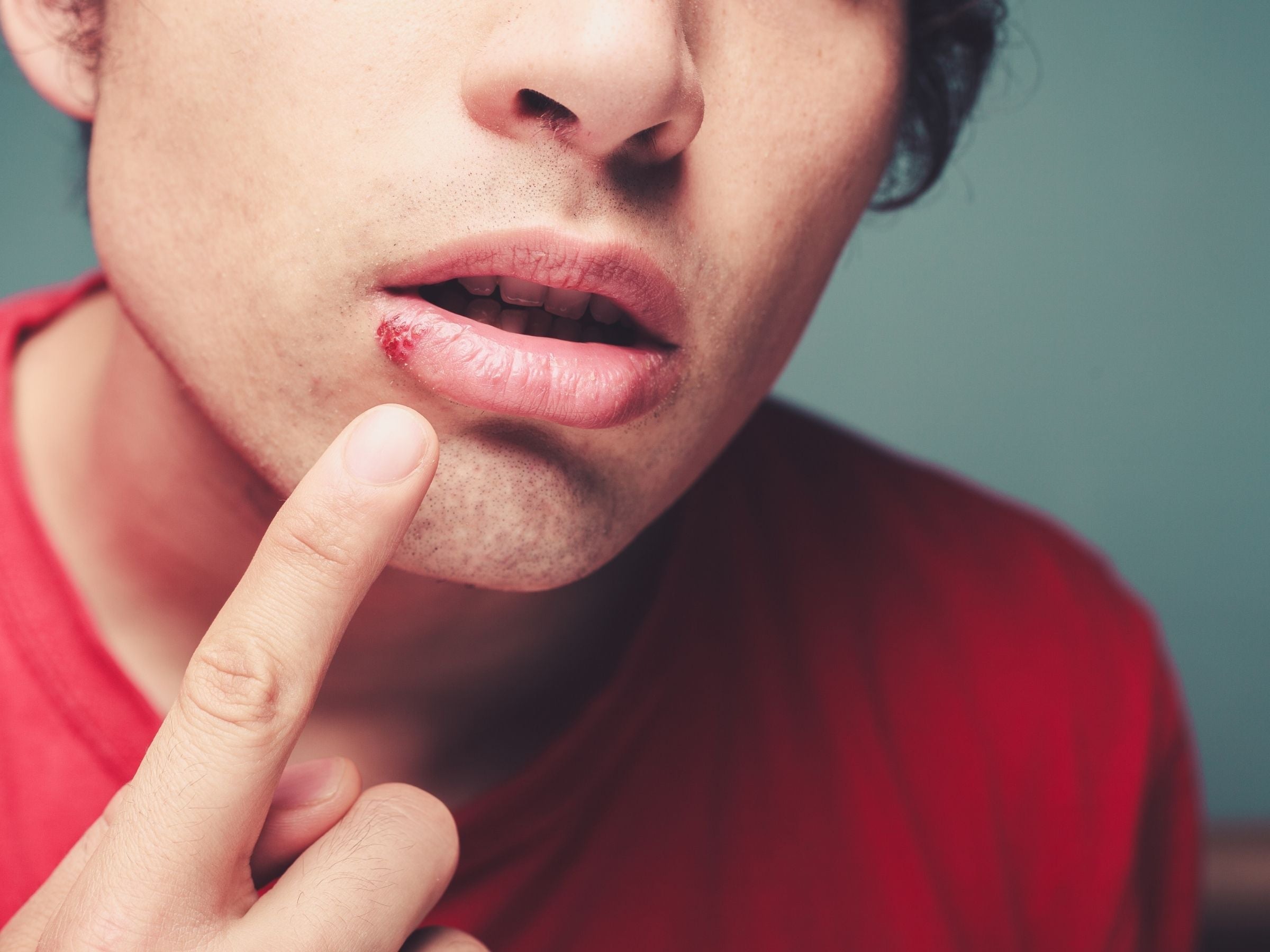Man touching cold sore on lip