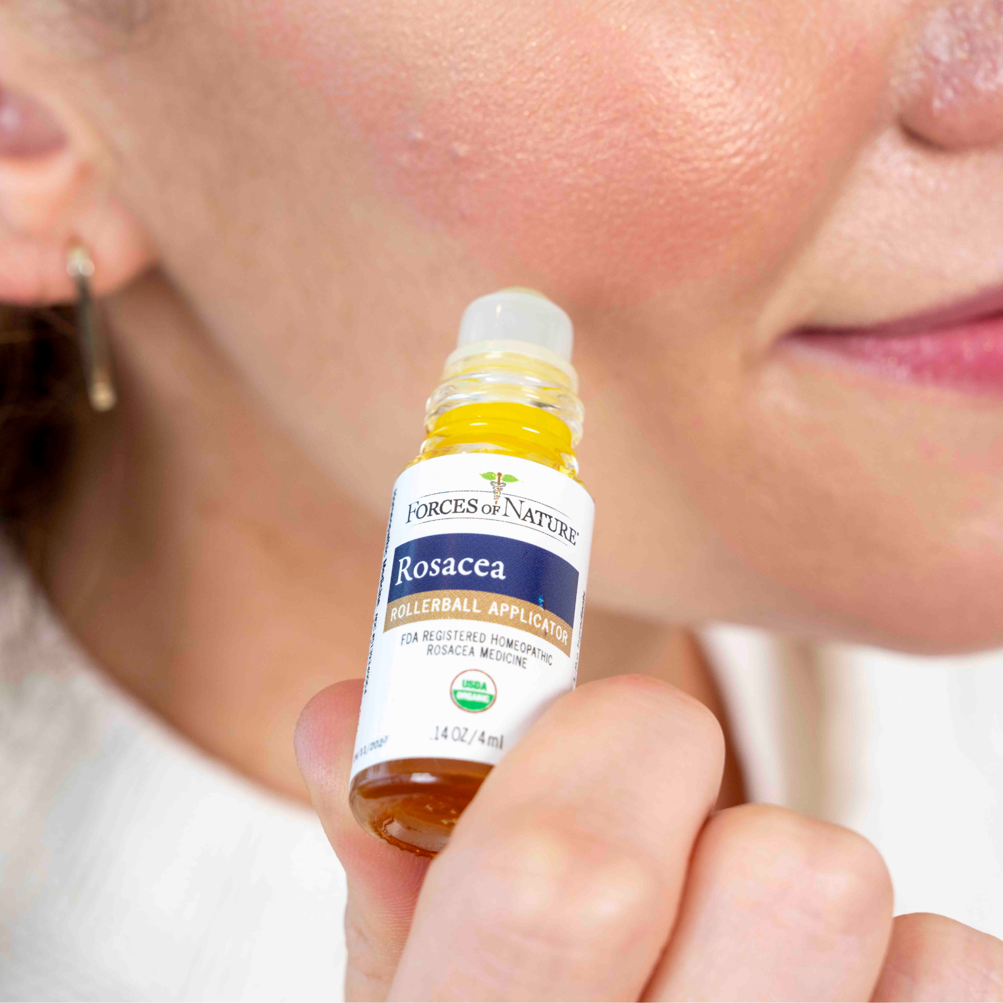 Rosacea Control